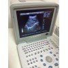 B/W ultrasound scanner