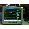 12.1 inch Patient monitor