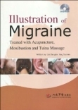 Illustration of migraine treated with acupuncture, Moxibustion and tuina massage