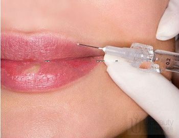 100 Unit BTX Dermal Filler for Plastic Surgery MD-H001