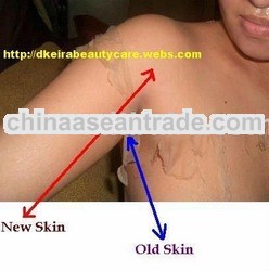 Body Skin Peeling Solution