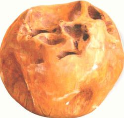 ROUND BALLS TEAK ROOT