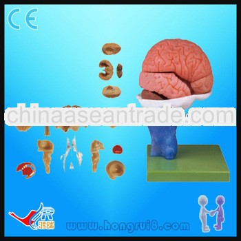 Advanced PVC Brain Model,Anatomical Brain Models