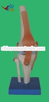 Vivid Life-size Artificial Knee Joint Model