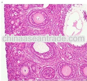 human ovary prepared slides