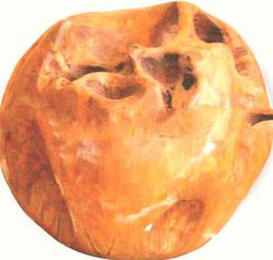 ROUND BALLS TEAK ROOT