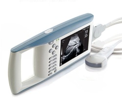 Palm Ultrasound Scanner