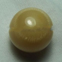 NATURAL PEARL OF CASSIS CORNUTA